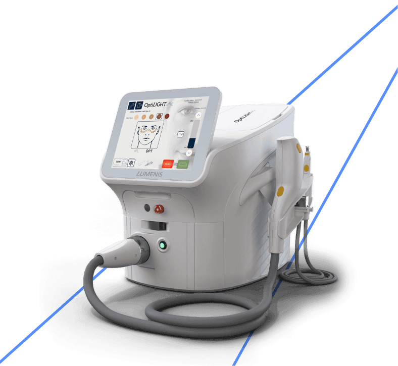 Lumenis OptiLight device used at New Path Vision